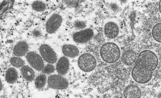 资料图：猴痘病毒电子显微镜图像。