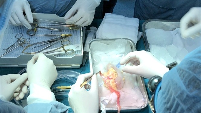 这是首个越南儿童患者成功接受跨地域器官移植手术。
